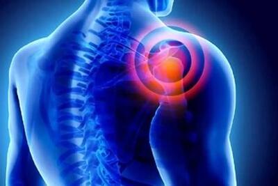  آیا سرما باعث درد شانه می‌شود؟/ شانه یخ‌زده چیست؟/ این درد درمانی دارد؟