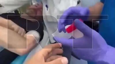  استیو سوینی، خبرنگار مجروح شده آرتی در حمله اسرائیل، ترکش‌های ناشی از انفجار را از بدنش خارج کردند
