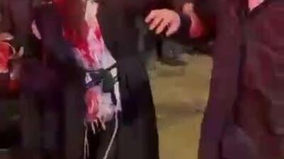  رسانه‌های اسرائیلی: در پی حمله موشکی ایران به عراد، دست کم 20 نفر کشته و بیش از 200 نفر زخمی شدند