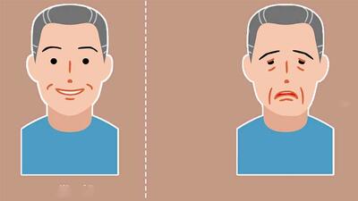  میاستنی گراویس چیست؟ / این افتادگی چشم را جدی بگیرید + فیلم