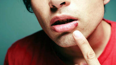  علت  چیست ؟ + فیلم