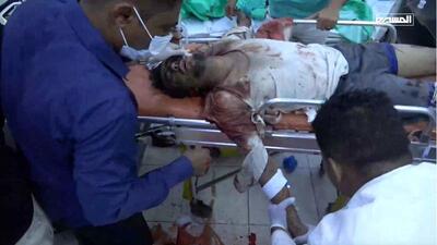 در صورت اصابت ترکش به بدن چه کنیم؟