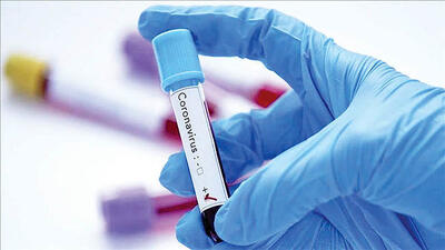  شناسایی سویه جدید کووید-۱۹؛ شیوع گسترده BA.3.2 در آمریکا