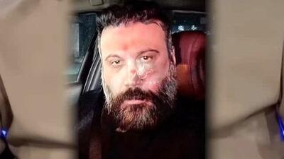  دانلود آهنگ محسن چاوشی / ریمیکس عاشقانه با صدای همراه با محسن ابراهیم زاده ، حمید عسکری