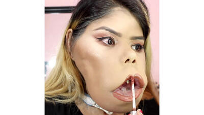  زنی با لقب میمون زیباترین چهره دنیا شد ! + عکس ها