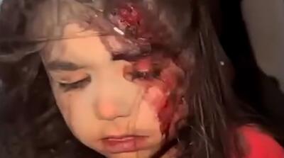  ویدیویی که علی ضیا از یک دختر بچه مظلوم منتشر کرد