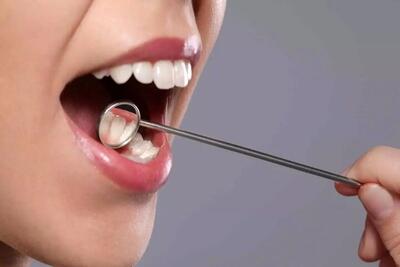  سپری طبیعی برای محافظت از دندان‌ها ساخته شد