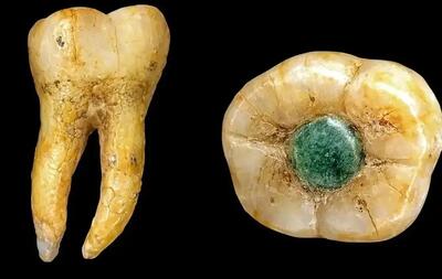  پیدا شدن دندان جواهرنشان تمدن مایا در گواتمالا