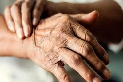  پارکینسون، بیماری پیش‌رونده‌ای که دیر تشخیص داده می‌شود