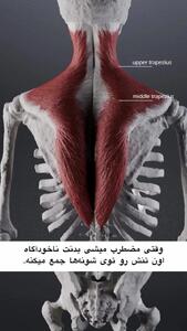  اگر این درد عضلانی را دارید یعنی اضطراب پنهان را تجربه می کنید + فیلم