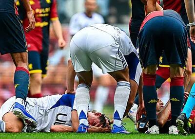  نیکو پاز بینایی‌اش را از دست داد!