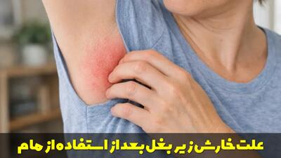  علت خارش زیر بغل بعد از استفاده از مام | درمان حساسیت به مام زیر بغل