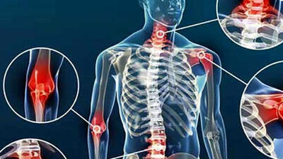 چرا درد مفاصل در بهار تشدید می شود؟