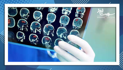  پژوهش جدید: مغز افراد سایکوپات شکل متفاوتی دارد