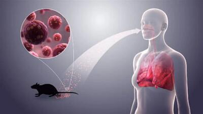  شیوع یک ویروس مرگبار، کل دنیا را ترسانده است!