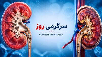  ۴ نشانه خطرناک سنگ کلیه که معمولا دیر تشخیص داده می‌شود | درمان خانگی پودر کردن سنگ کلیه