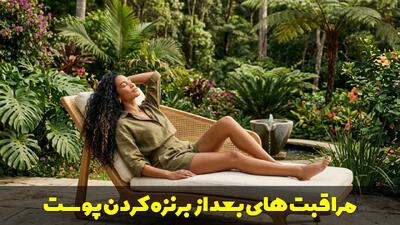  مراقبت های بعد از برنزه کردن پوست چیست؟ راهنمای کامل