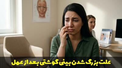 علت بزرگ شدن بینی گوشتی بعد از عمل چیست ؟