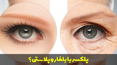 پلکسر یا بلفاروپلاستی؟ تفاوت و راهنمای انتخاب مناسب