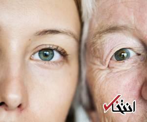  کدام کرم دور چشم برای سن شما مناسب است؟