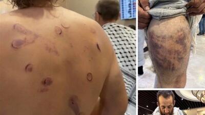  دیگر نمی توان «نکبت» صهیونیسم را لاپوشانی کرد