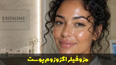  مزوفیلر اگزوزوم؛ مزایا، کاربردها و تاثیر آن روی پوست