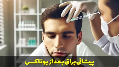  پیشانی براق بعد از بوتاکس | دلایل، راه حل ها و نکات مهم