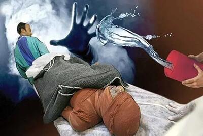  اسیدپاشی مرگبار به برادر
