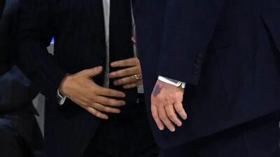  ادعای عجیب پزشک کاخ سفید درباره دست حاشیه ساز ترامپ