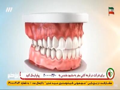  دوستان و دشمنان دندان!