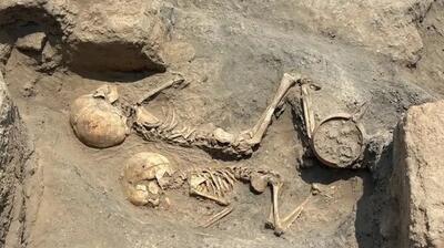 جراحی جمجمه در آسیای مرکزی ۴۰۰۰ سال قبل