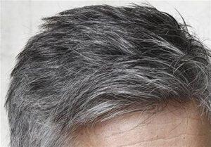  علت سفید شدن مو چیست؟