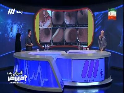 اندوسکپی روشی برای پیشگیری از برخی بیماری ها