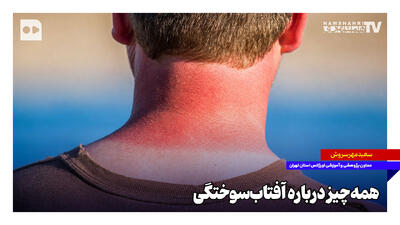 همهچیز درباره آفتابسوختگی