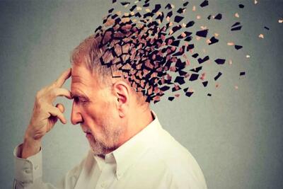 بیماری آلزایمر چه علائمی دارد؟