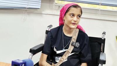 آیا نارین قربانی خشونت پدرش دوباره لبخند میزند؟ / ۳۰۰ نفر کادر درمان برای این دختر سنندجی پای کار آمدند