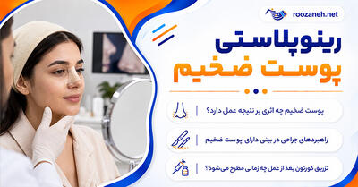 رینوپلاستی پوست ضخیم؛ نتیجه عمل بینی گوشتی و مدت ماندگاری ورم؛ مراقبتها و انتظارات واقعبینانه