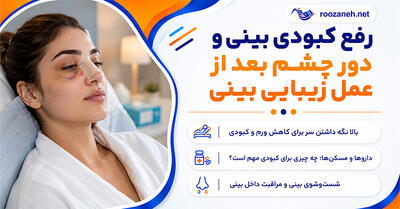  رفع کبودی بینی و دور چشم بعد از عمل زیبایی بینی؛ مراقبت‌ها، زمان بهبود و نکات مهم