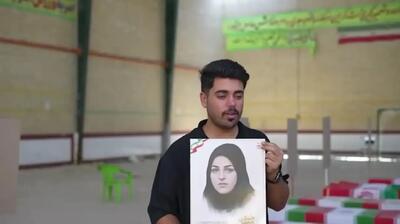  عکس تکان دهنده از یک کودک خردسال بعد از اصابت ساچمه به صورتش