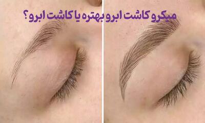 میکرو کاشت ابرو بهتره یا کاشت ابرو؟