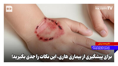  برای پیشگیری از بیماری هاری این نکات را جدی بگیرید