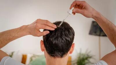  آیا ماینوکسیدیل برای نوجوانان بی‌خطر است؟
