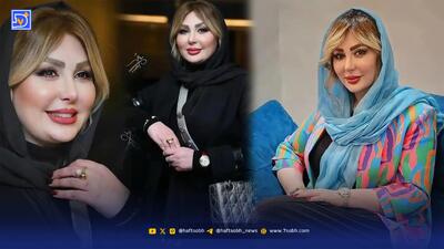  نیوشا ضیغمی از تجربه بوتاکس و نگاهش به جذابیت مردان گفت
