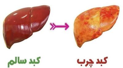نوشیدنیهای صبحگاهی برای کبد چرب