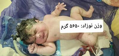 تولد نوزاد ۵ کیلو و ۶۵۰ گرمی در بیمارستان امام رضا(ع) کرمانشاه