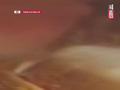 خارج شدن پروانه زنده از گوش مرد ۴۰ ساله