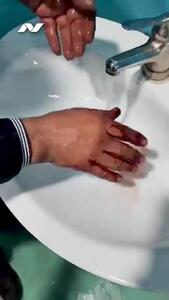  چرخه باطل دلسوزی و خشونت /پشت پرده غذارسانی ناآگاهانه به سگ‌ها  و ناکارآمدی شهرداری