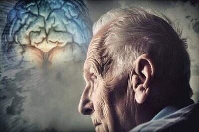 شناسایی ضعف بدن به عنوان نشانگر اولیه زوال عقل