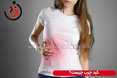 از خستگی تا درد شکم؛ این علائم میتوانند نشانه کبد چرب باشند