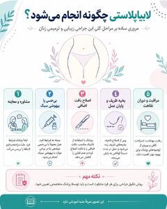 افزایش تقاضا برای لابیاپلاستی؛ جراحیای با اهداف زیبایی و عملکردی